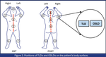 Transitioning from OSLDs to TLDs for in-Vivo Dosimetry in Total Skin Electron Therapy: A Clinical Perspective